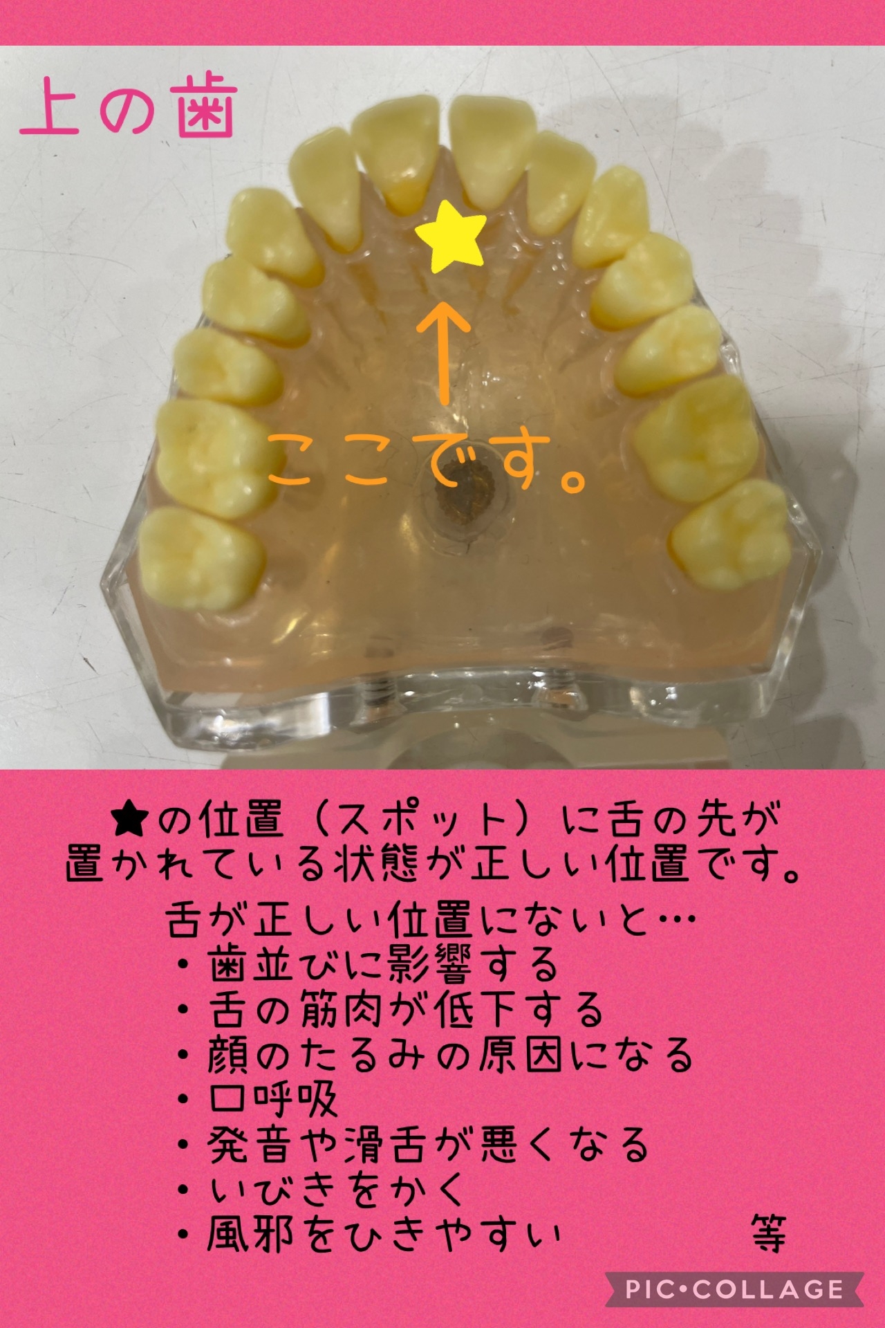 舌