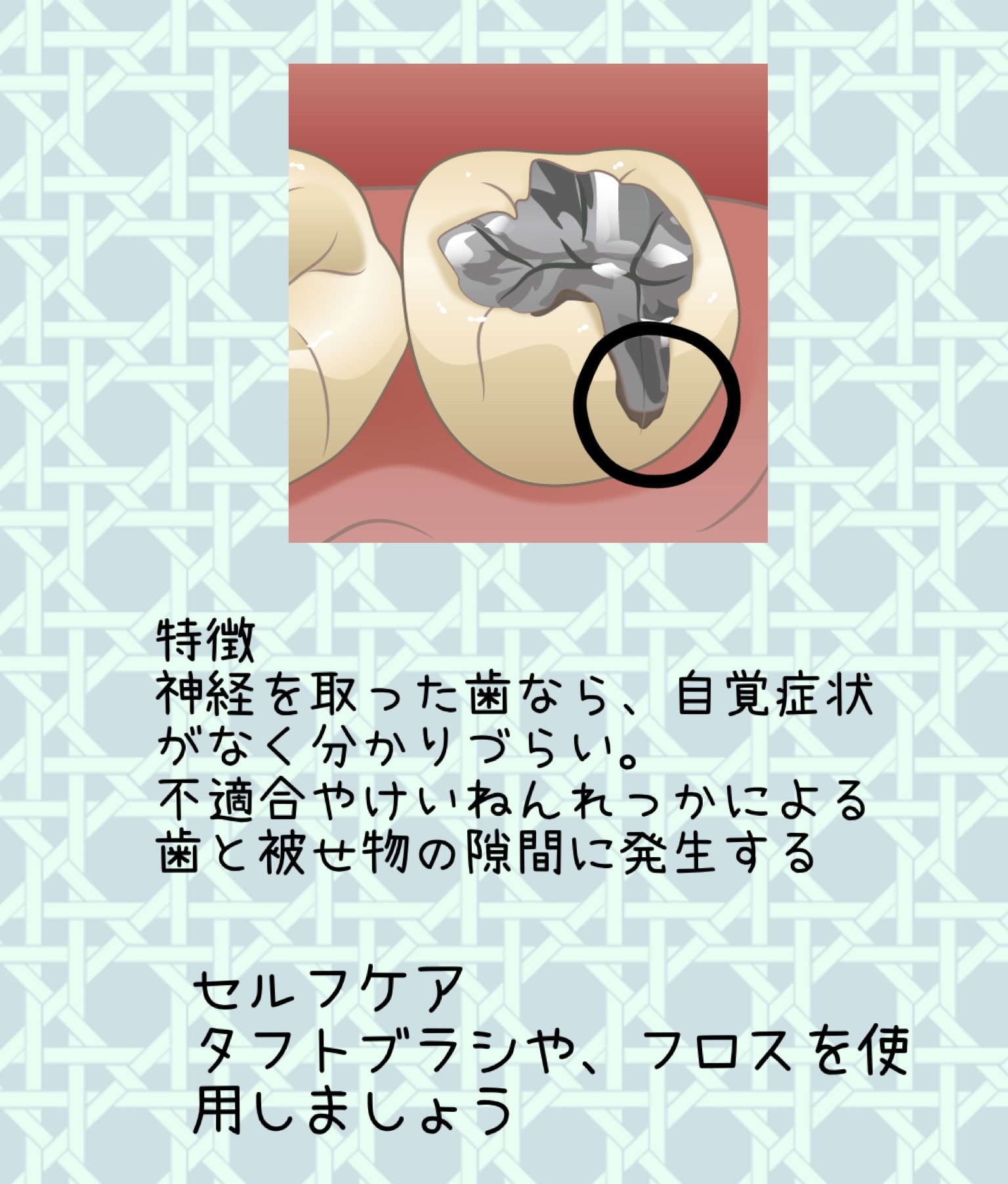 あ